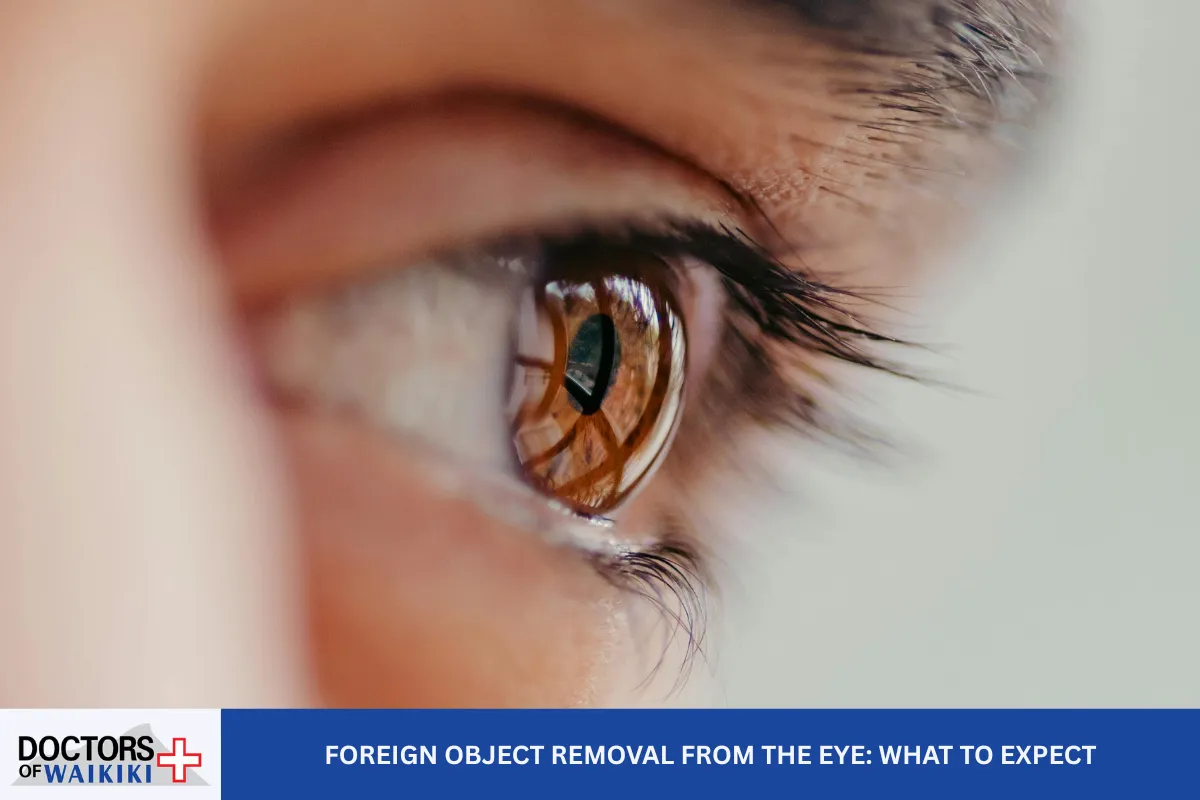 Foreign Object Removal from the Eye: What to Expect
