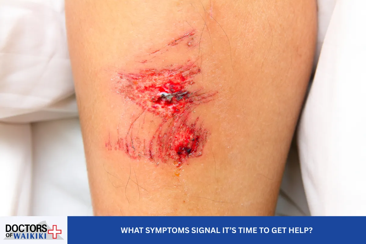 What Symptoms Signal It’s Time to Get Help?