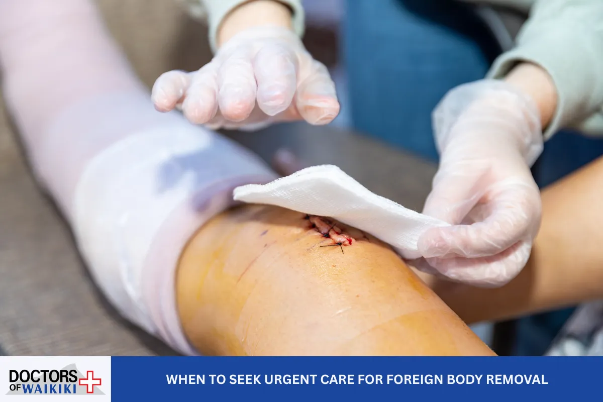 When to Seek Urgent Care for Foreign Body Removal