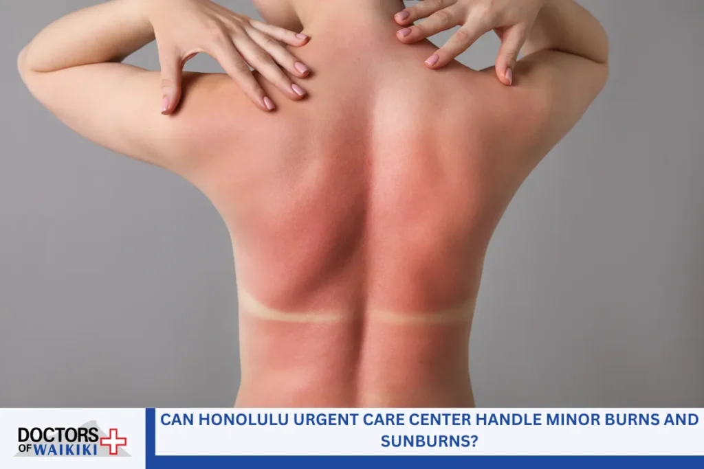 Can Honolulu Urgent Care Center Handle Minor Burns and Sunburns?