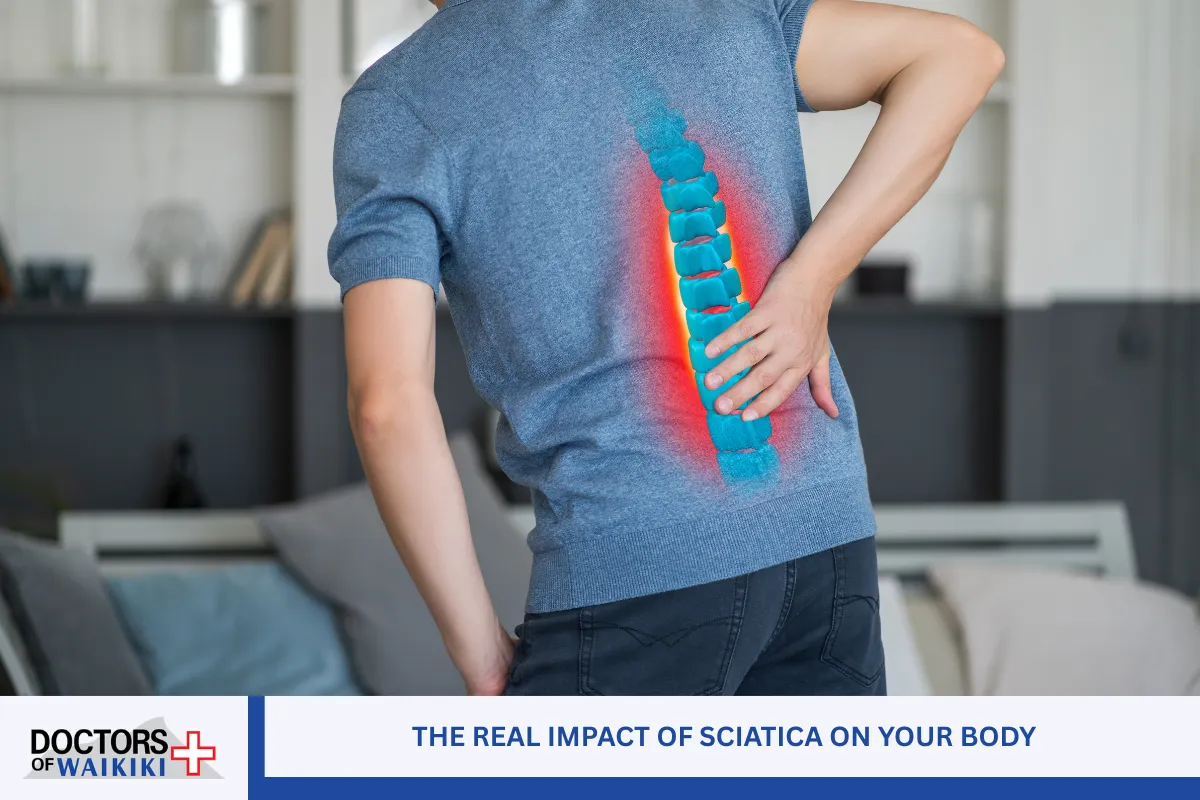 The Real Impact of Sciatica on Your Body