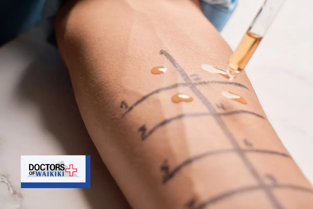 How to Choose the Right Honolulu Urgent Care Clinic for TB Screening