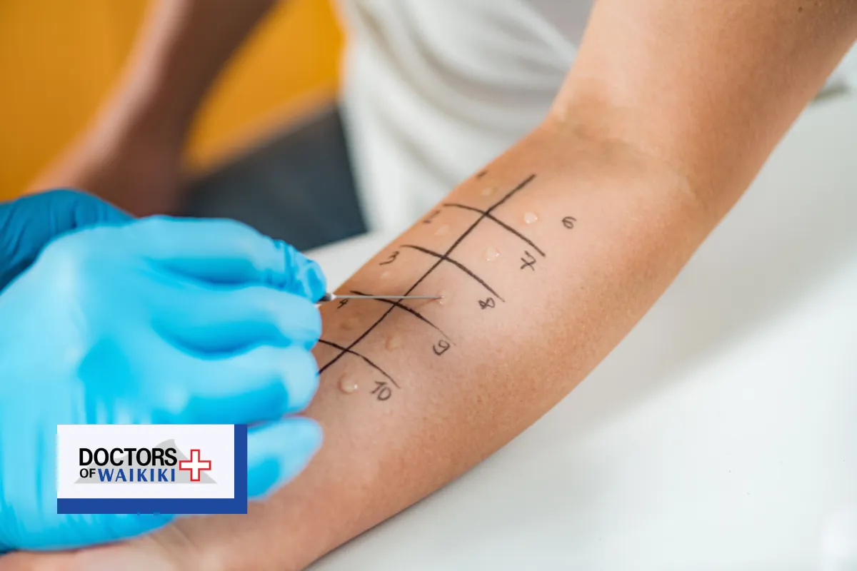 Understanding Your TB Test Options: Skin Test vs. IGRA Blood Test