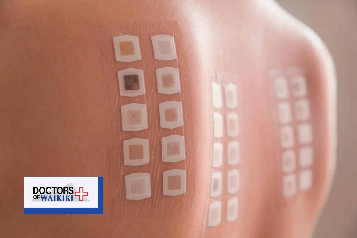 Where to Get a TB Skin Test or IGRA Blood Test in Honolulu, HI